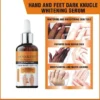 hand & foot dark knuckle whitening serum niacinamide vitamin c