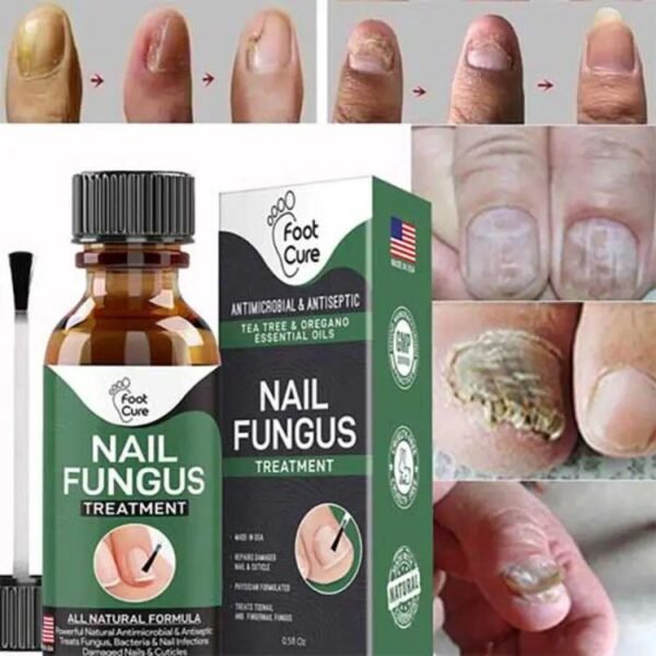 Nail Fungus Treatment oil