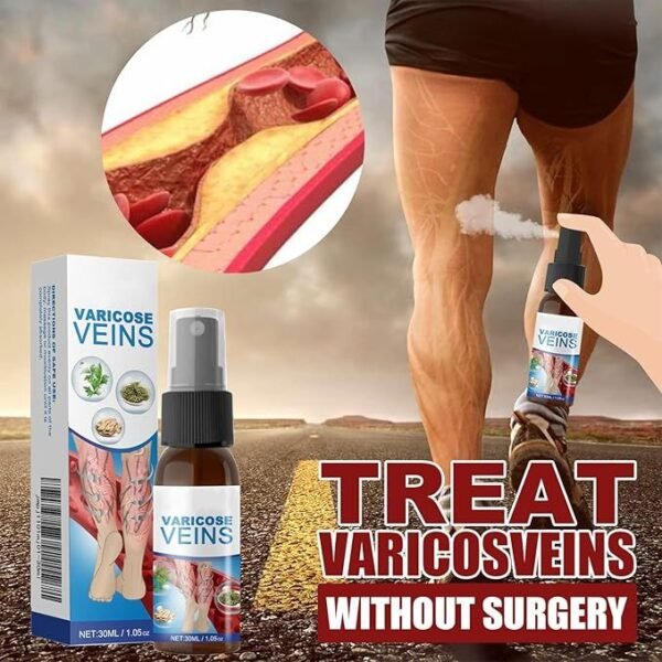 Varicose Vein Spray for Body Care